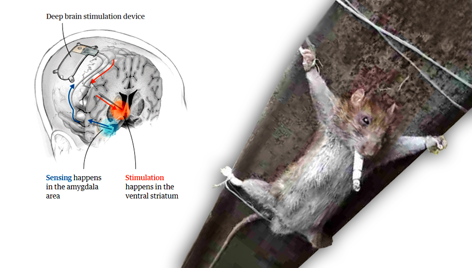 Имплант от депрессии уподобляет пациента крысе-наркоманке